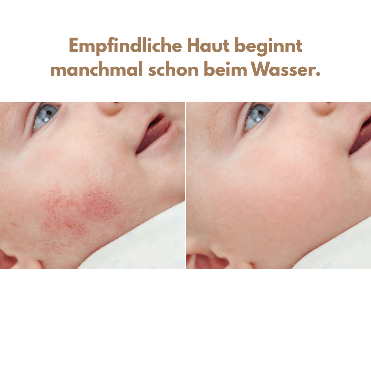 SMOVO Pure – Der Duschkopf mit Filter für Babyhaut